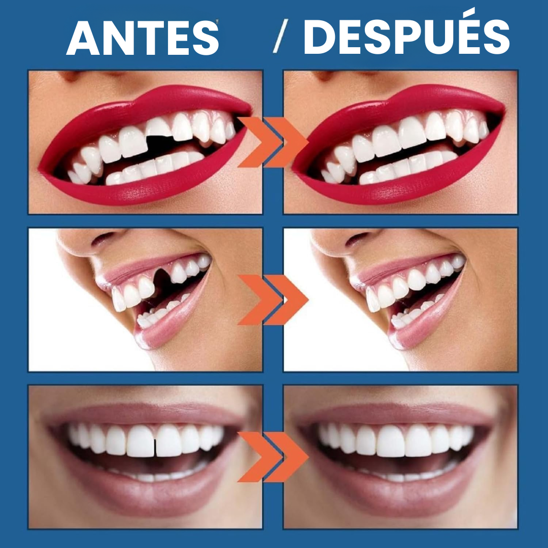 DentaSeal™ - Repara tu sonrisa en minutos